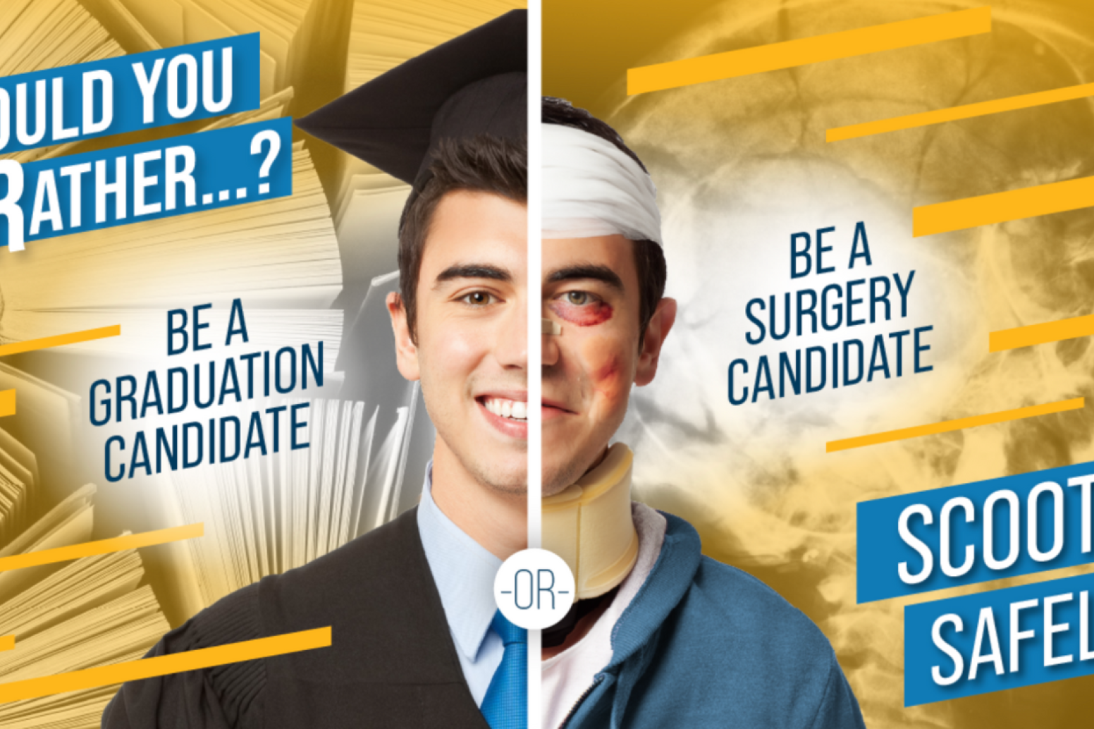 Would you rather be a graduation advocate or a surgery candidate? Scooter safety